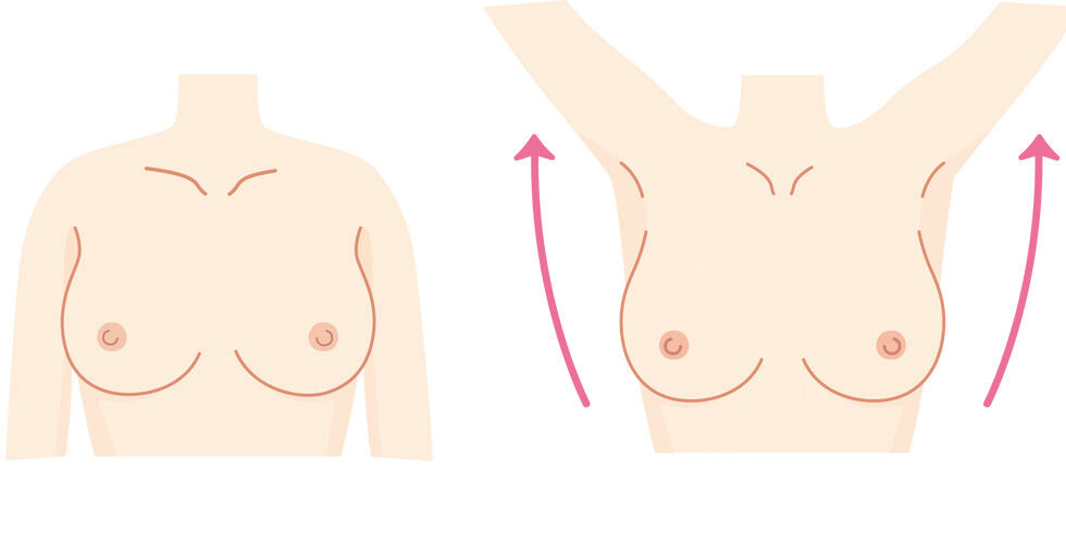 Mes-rosa-autoexploracion-mamaria-Ilusion